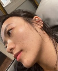 -苗方清颜痘肌研究所