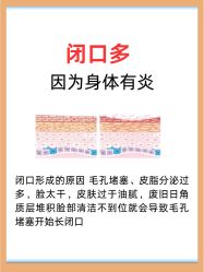 -克丽缇娜