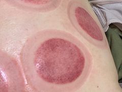-沈师傅盲人按摩工作室(密三小区店)