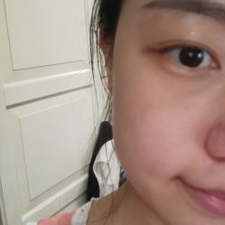 体验后-北京米扬丽格医疗美容·联合丽格鼻整形中心