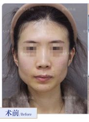 -圣嘉新医疗美容医院