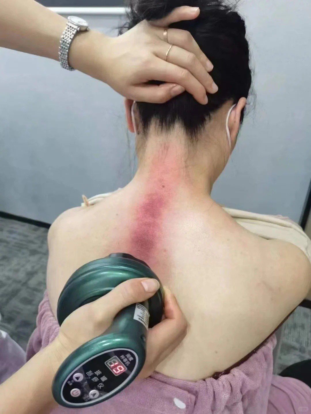 刮痧,养生的第一步