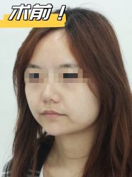 -素美医疗美容·西南眼鼻整形·修复基地