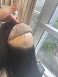 -发饰美男士增发补发假发定制店