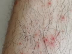 -华夏良子·足道SPA艾灸(铁道大厦店)