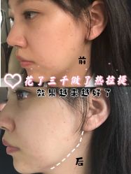 -上海时光整形外科医院