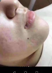 -痘院长·祛痘·皮肤管理