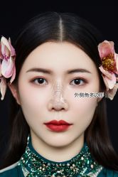 -北京米扬丽格医疗美容·联合丽格鼻整形中心