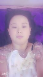 点击看大图 -寇氏拔罐减肥