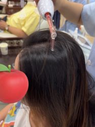点击看大图 -大麦微针植发全国连锁