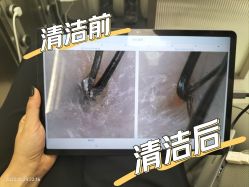 -润复丝·泽发防脱头皮管理