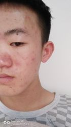 -Dr.ACNE痘院长祛痘皮肤管理连锁