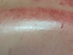 -安琪盲人按摩调理草本熏蒸馆(风和日丽店)