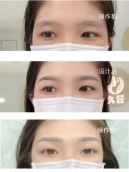 -久匠半永久纹眉