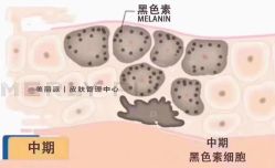 -MLP美丽派·问题肌疗愈中心
