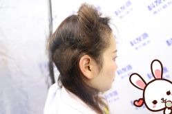 -大麦微针植发丨全国连锁