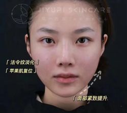 -MLP美丽派·问题肌疗愈中心