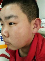 -北京美痣堂古方祛痣斑疣瘊