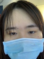 体验前-深圳美莱医疗美容医院