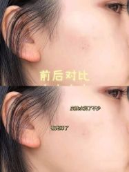 -上海漾颜医疗美容