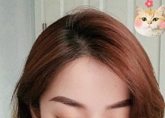 -大麦微针植发丨全国连锁