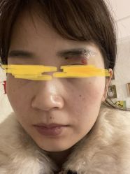 -大华韩艺整形美容医院