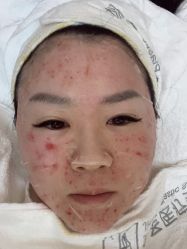 体验后-金圣医疗美容