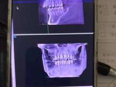 -土豆口腔(凤凰北总店)