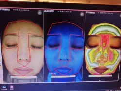 点击看大图 皮肤诊断-光SPA科技美肤