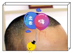 -大麦微针植发全国连锁