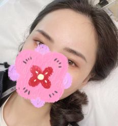 -Doris多里斯半永久纹眉·SMP纹发·发际线