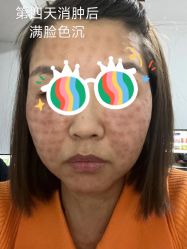 -海涛医疗美容·面部抗衰·注射美鼻