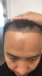 -熙朵美学植发连锁