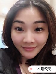 -天津健丽·去眼袋医疗美容机构