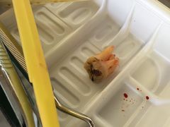-上海仁爱医院口腔科 · 种植