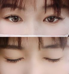 -宥莉·ULLY 痘敏肌•科技皮肤管理中心