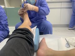-Andrew指甲专科灰指甲·甲沟炎矫正·3D步态矫形鞋垫定制(浦三路店)