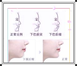 -维秘形体医美 M·VVON医生集团