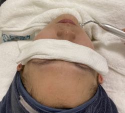 -安那般那皮肤年轻化ANAPANA