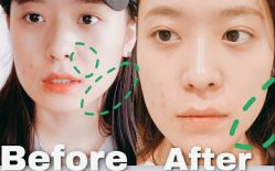 -SKINIST丽铂医疗美容