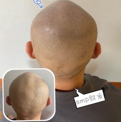 -西施无菌半永久纹绣眉眼影唇轻增发纹发际线