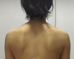 -深圳悦她医疗美容