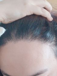 -新生植发·植养护一体