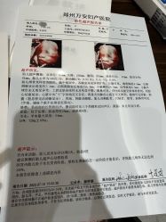 -郑州万安妇产医院