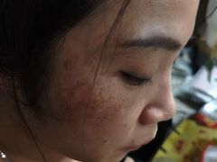 -上海爱以德护理院·康复(宝山院)