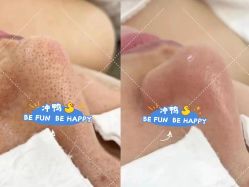 -Fundi张玉珊修身堂·indiba·BTL科技瘦身