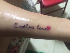 点击看大图 -新肤洗纹身