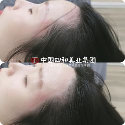点击看大图 -西施无菌半永久纹绣眉眼影唇轻增发纹发际线