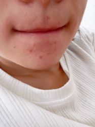 -痘博士天津·全国连锁祛痘机构