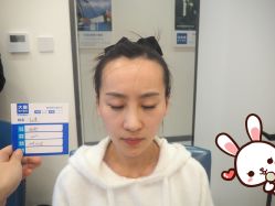 -大麦微针植发丨全国连锁